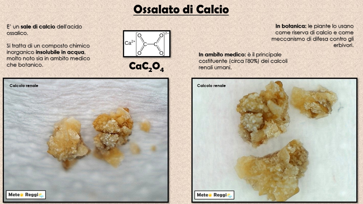L'acqua del rubinetto non fa venire i calcoli, parliamo di Ossalato di Calcio